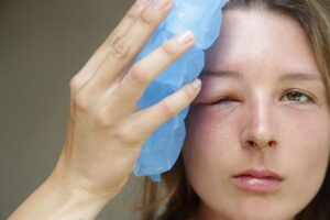 Bee & Wasp Stings – Take These Seriously