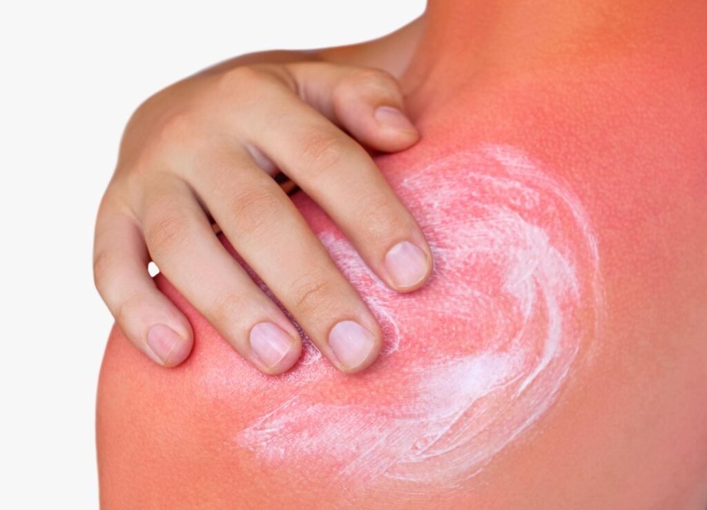 heat exhaustion prevention