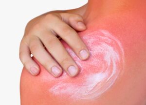 heat exhaustion prevention